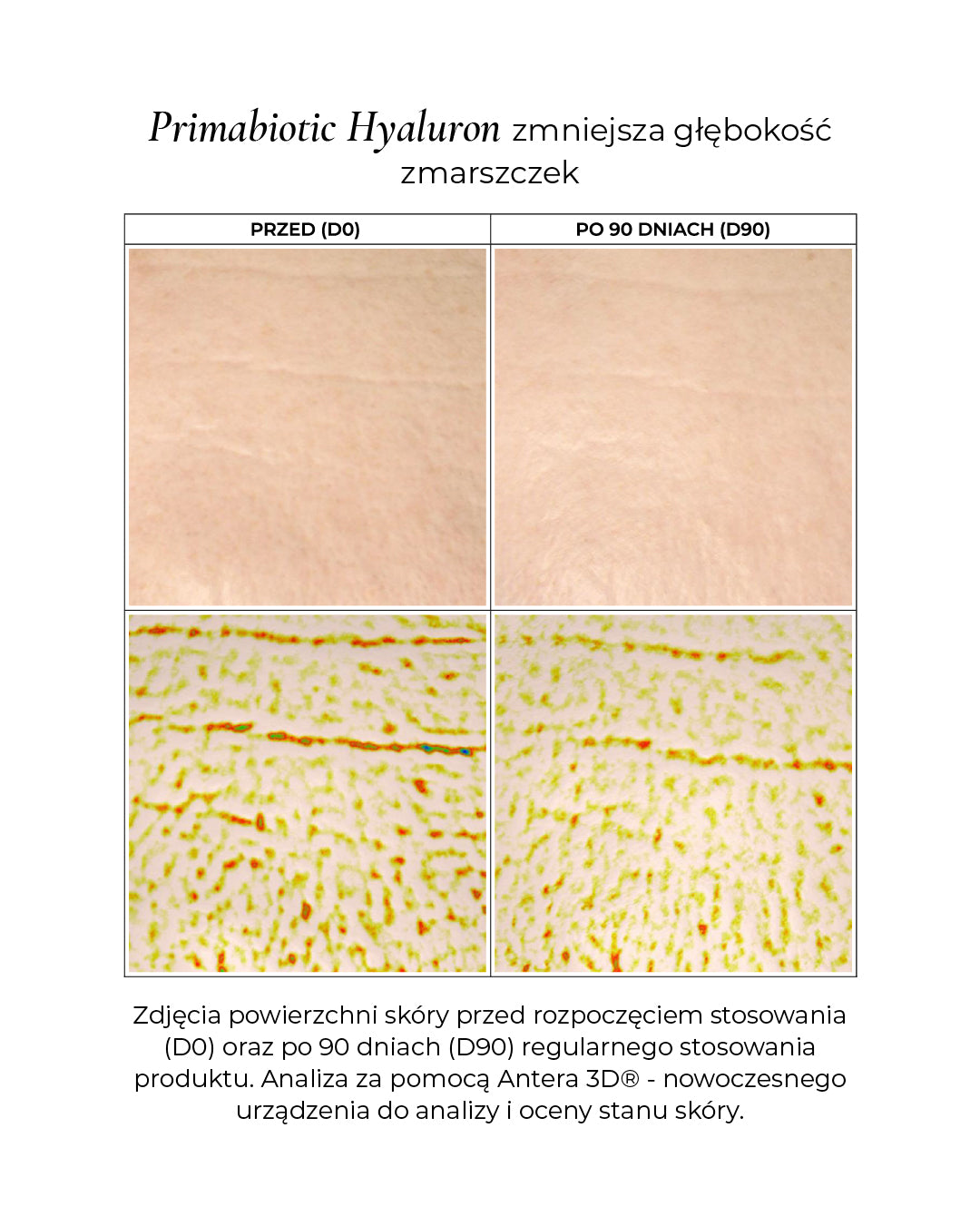 Efekty suplementacji kwasu hialuronowego do picia Primabiotic po 90 dniach regularnego stosowania