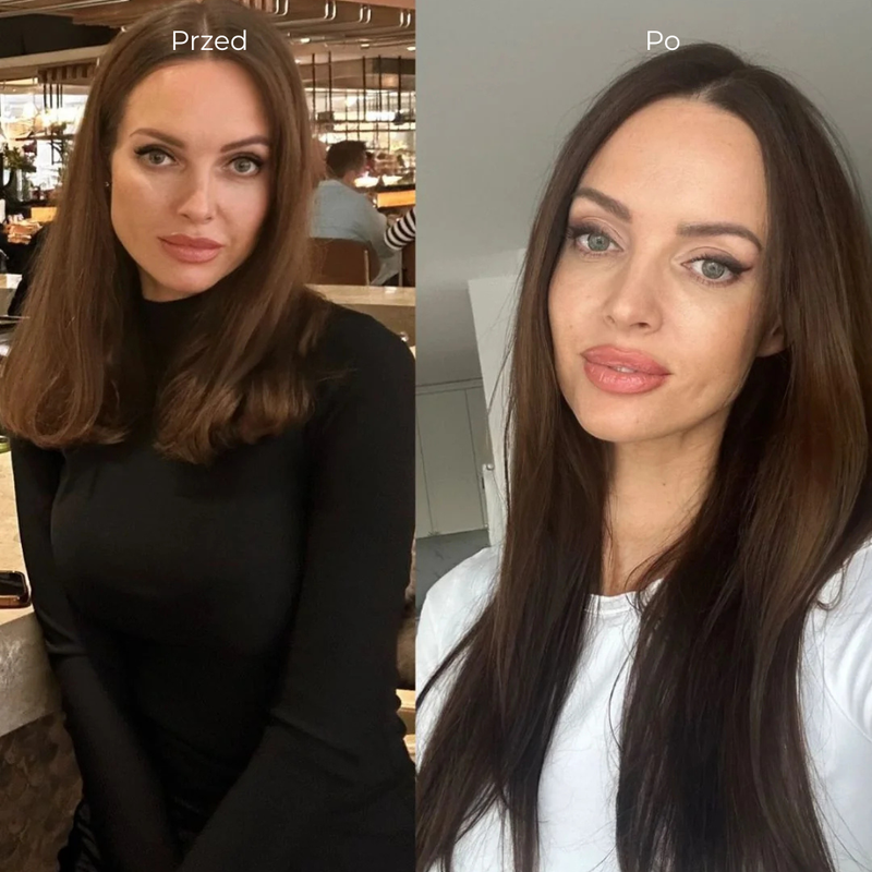 Efekty stosowania kolagenu do picia  kobiety - widoczny porost włosów po suplementacji Primabiotic Collagen