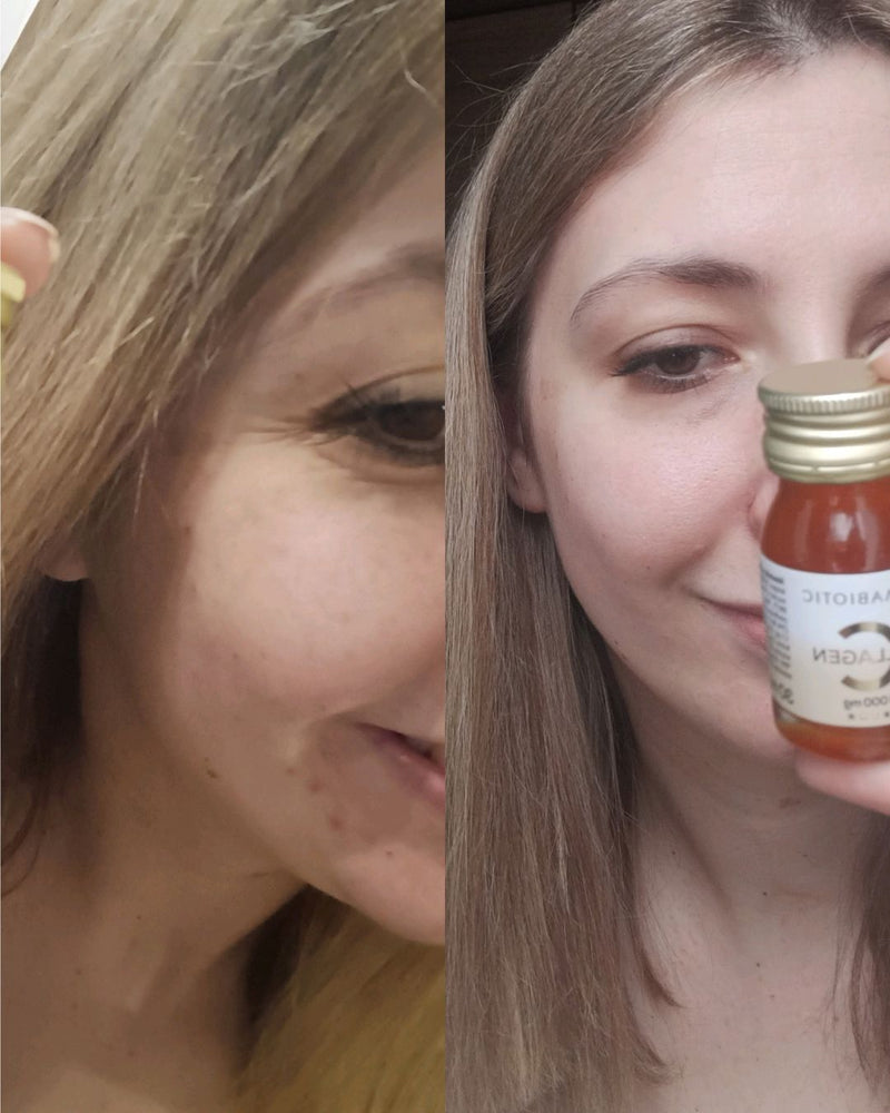 kobieta prezentująca efekty suplementacji kolagenu do picia Primabiotic Collagen - poprawa skóry twarzy, zmniejszona ilość wyprysków